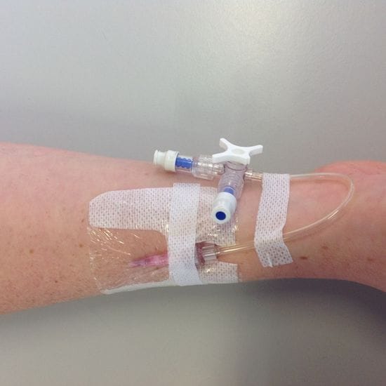 How to assess a peripheral intravenous (IV) cannula